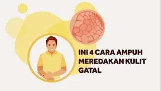 4 Cara Ampuh Meredakan Kulit Gatal