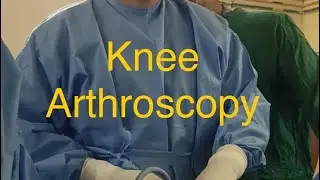 Arthroscopic ACL reconstruction with peroneus longus graft #sportsinjury #ligaments #injury #scopy