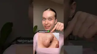 Как я очистила черные точки ✅ 