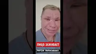 ЛИЦО ЗАЖИВАЕТ, ЗАВТРА ВЫПИСКА 