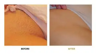 How To Remove Facial Hair At Home Remedy| Priya Creations|