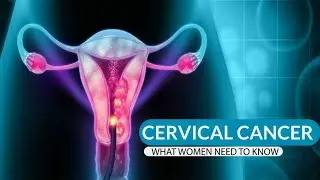 Womanity Africa (Eps. 8): Cervical Cancer, What Women Need to Know