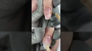 Nail Rebalancing using Acrygel  