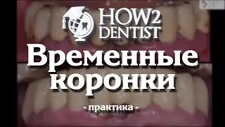 How to Make Temporary Crowns. Part 3 - Hands-on / How to Dentist