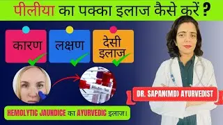 Hemolytic/Pre-hepatic Jaundice Causes, Signs,Ayurvedic treatment/Jaundice Ayurvedic treatment/पीलिया