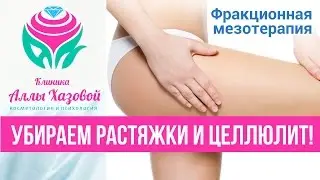 Фракционная мезотерапия. Лечение целлюлита в Москве. Эффективная борьба с целлюлитом.