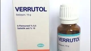 siğil tedavisinde verrutol kullanımı mutlaka izleyin