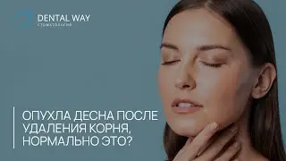 Опухла десна после удаления корня, нормально ли это?