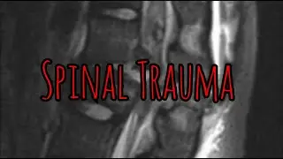 Prolonged Field Care Podcast 204: Spinal Trauma