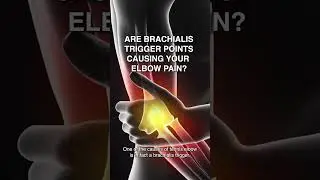 Are Brachialis Trigger Points Causing your Elbow Pain?