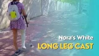 Nora Fiberglass Long Leg Cast Preview