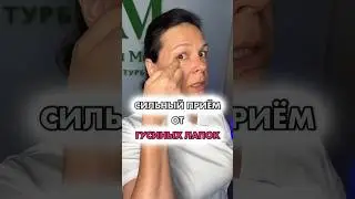 Как избавиться от гусиных лапок.
