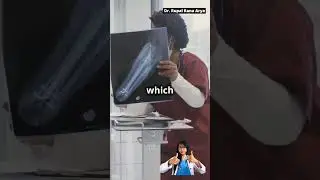 3D प्रिंटिंग के साथ ओपन ग्रोथ प्लेट्स 