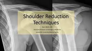 The Dislocated Shoulder Playbook: A Presentation on Reductions That Actually Work