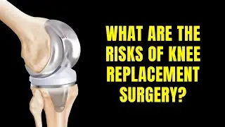 What Are the Risk Of Knee Replacement Surgery
