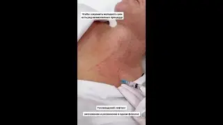 КАК СОХРАНИТЬ МОЛОДОСТЬ ШЕИ? 🔥