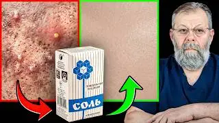 SALT AND WATER - THE SECRET OF PERFECT SKIN AND HEALTHY BILE