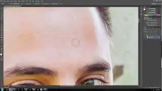How To Remove Skin Blemishes, Zits, Acne In Photoshop CS5 CS6