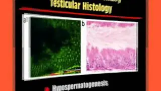 Multiphoton Microscopy:Potential Clinical Application to Guide Testicular Sperm Extraction