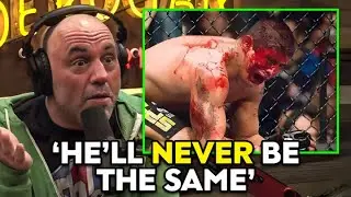 WORST MMA Injuries Of All Time REVEALED..