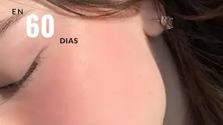 Como tener una piel de cristal