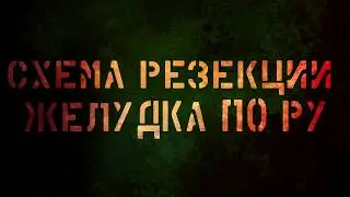 Схема резекции желудка по Ру