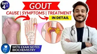 gout biochemistry | cause and symptom of gout | treatment of gout biochemistry