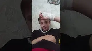 поломал руку 😭