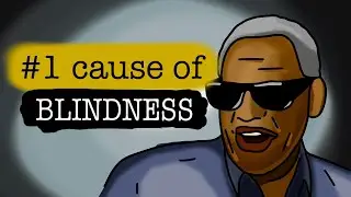 Macular Degeneration - The leading cause of BLINDNESS in the world