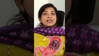 വയറ്റിൽ അൾസർ വളരുന്നതിന്റെ ആദ്യ ലക്ഷണങ്ങൾ / Dr Thrishna #baijusvlogs