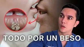 Enfermedades transmitidas por un beso | Dr. William Guerrero
