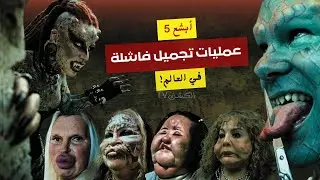 أبشع 5 عمليات تجميل فاشلة قامت بها النساء في العالم | انتهت بنتائج كارثية لن تصدق مآ سوف ترآه !