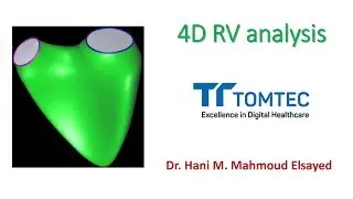 4D RV analysis using TomTec software (step-by-step)