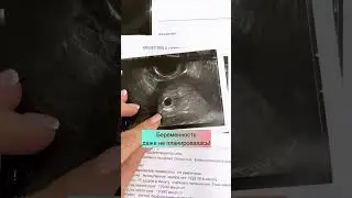Преждевременное истощение яичников