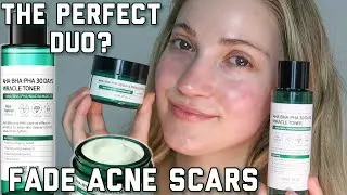 Some By Mi AHA, BHA, PHA 30 Days Miracle Toner & Cream Review | INCLUDES BEFORE & AFTER PICTURES