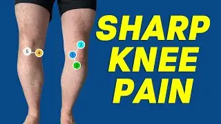 5 Causes of Sharp Stabbing Pain in the Knee That Comes and Goes!