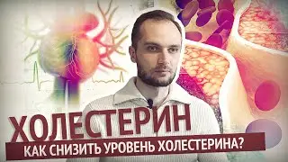 Холестерин. Как снизить уровень холестерина? Омега-3. Статины. Инновационные препараты