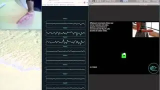 Augmented Reality in  rehabilitation