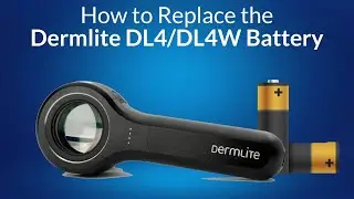 Dermlite DL4/DL4W Battery Replacement