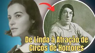 COMO UMA BELA JOVEM SE TRANSFORMOU NA "MULHER MAIS FEIA DO MUNDO" | A Trágica História de Bevan