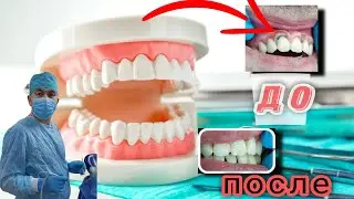 НИМА УЧУН ТИШ ТОШИНИ ТОЗАЛАШ КЕРАК !? 