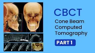 Read CBCT part 1 - Basics, Uses, Interpretations, Technical terms of Cone Beam CT 