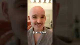 Glatzenpflege-Tipps von Christos! #wenighair #glatze