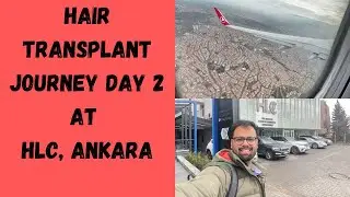 Turkey Hair Transplant |  Day 2 VLOG in Ankara | HLC clinic