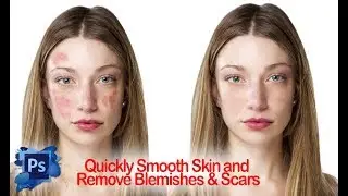how to remove blemishes & scars in photoshop cc 2017