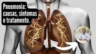 PNEUMONIA: CAUSAS, SINTOMAS E TRATAMENTO