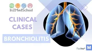 Bronchiolitis Clinical Case