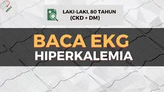 BACA EKG (HIPERKALEMIA + LAFB) | EP.9