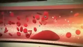 Гирудотерапия - Лечение пиявками. Красноярск