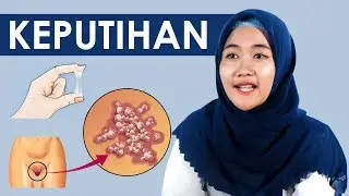 PRIA & WANITA HARUS TAHU !!! Jenis-Jenis, Cara Mengobati Dan Cara Mencegah Keputihan